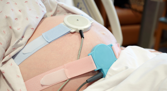 Monitoring accouchement : à quoi ça sert ? 