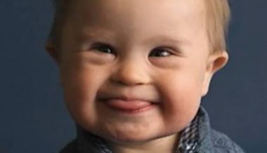 Un Bebe Atteint De Trisomie Remporte Un Concours De Photos Droles De Mums