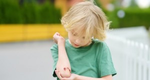 wound-child-trauma-elbow-injured-abrasion-scratch-boy-falling-injury-first-aid-bruise-hurt-accident_t20_jj9jbp